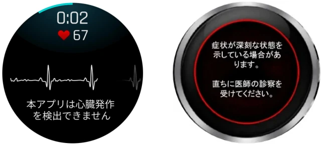 心電図アプリ画面のイメージ